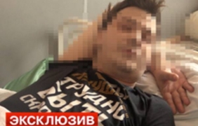 Руски актьор се събуди без тестиси на автобусна спирка