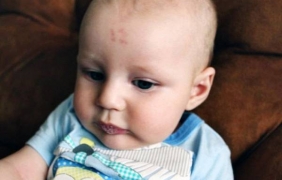 Роди се уникално бебе с изписано число 12 на челото